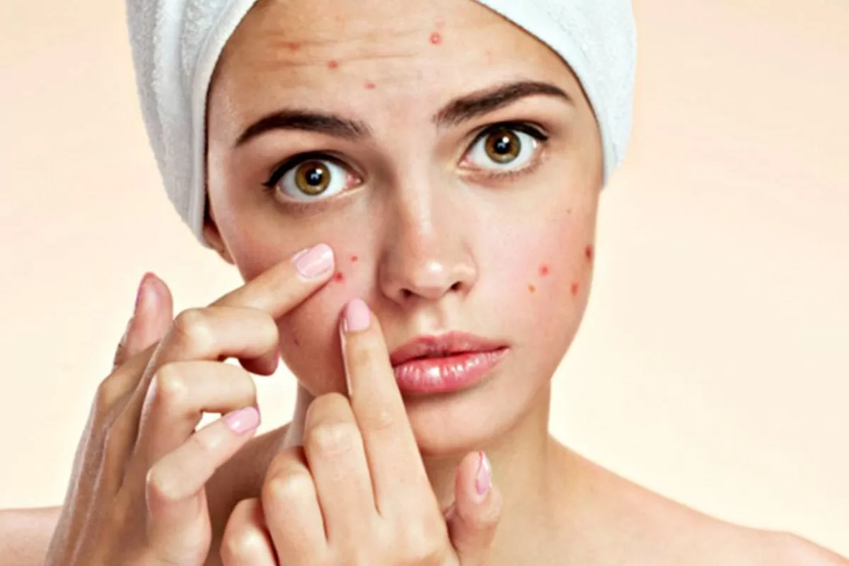 Maquiagem para pele acneica conheça os produtos que aliam beleza e tratamento
