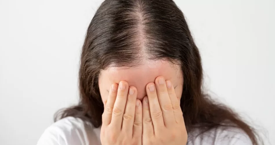 Alopecia Feminina: o que é, causas e como tratar
